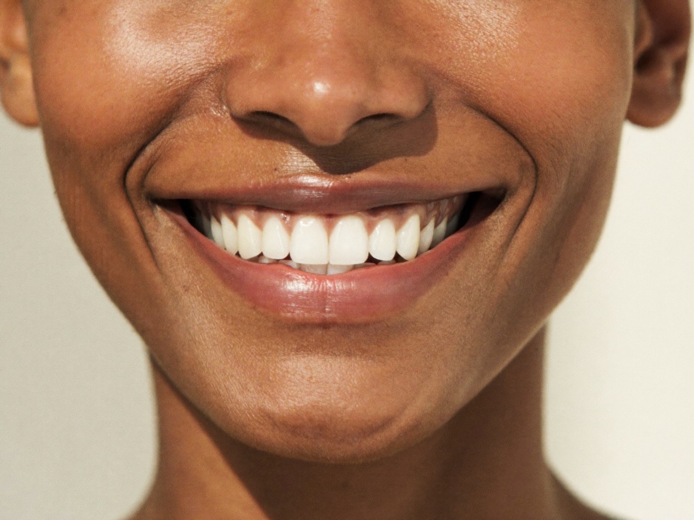 Close-up of a bright, healthy smile after whitening